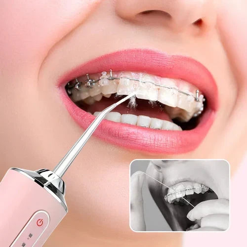 Portable Water Flosser for Fresh Breath & Deep Teeth Cleaning